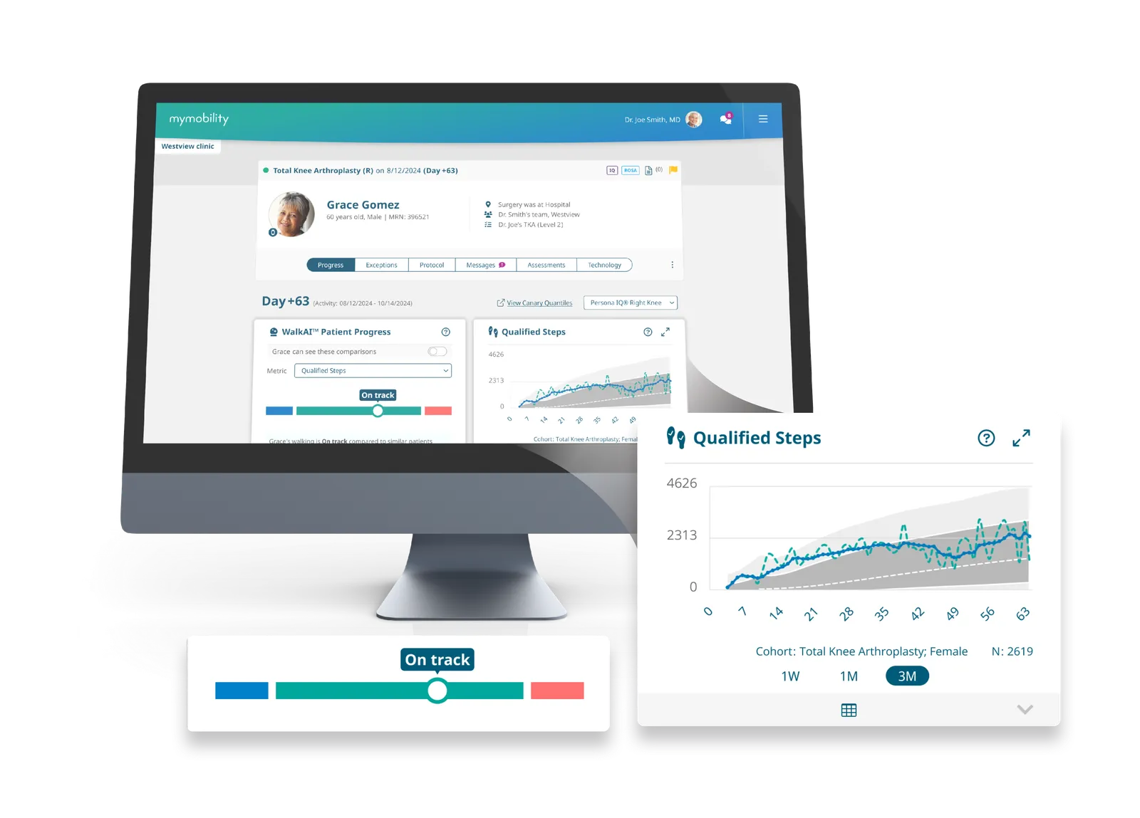 Example care team dashboard showing a patient's qualified steps over time compared with similar patients